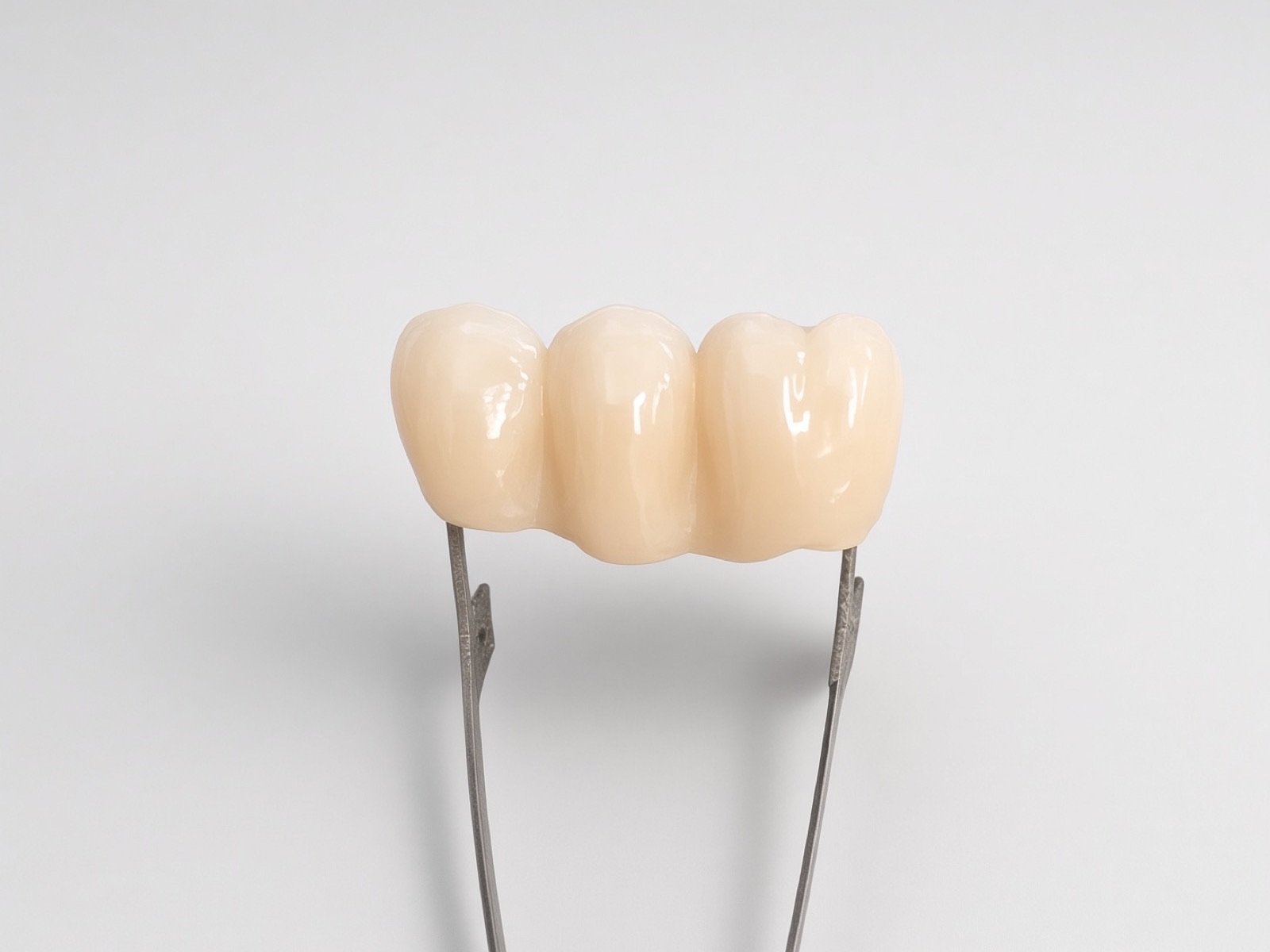 Zirconia bridge.